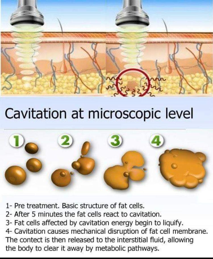 Microneedeling in Mossel Bay and George